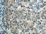 PTPN22 Antibody in Immunohistochemistry (Paraffin) (IHC (P))