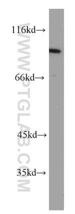 PTPN22 Antibody in Western Blot (WB)