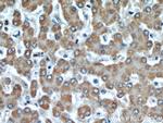 DIO1 Antibody in Immunohistochemistry (Paraffin) (IHC (P))