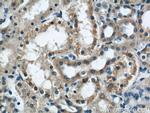 DIO1 Antibody in Immunohistochemistry (Paraffin) (IHC (P))