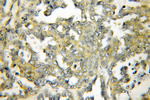 DIO1 Antibody in Immunohistochemistry (Paraffin) (IHC (P))