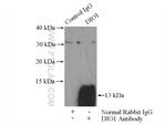 DIO1 Antibody in Immunoprecipitation (IP)