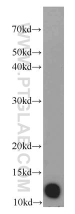 DIO1 Antibody in Western Blot (WB)