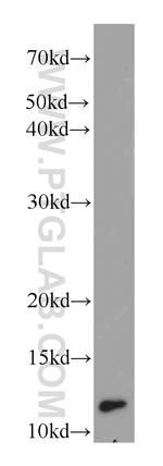 DIO1 Antibody in Western Blot (WB)