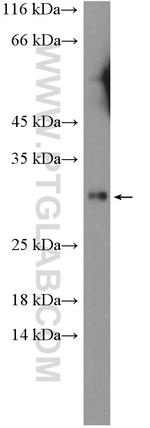 DIO1 Antibody in Western Blot (WB)