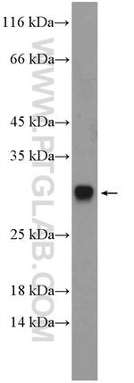 DIO1 Antibody in Western Blot (WB)