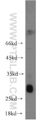 TREM1 Antibody in Western Blot (WB)