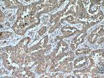 RAB8B Antibody in Immunohistochemistry (Paraffin) (IHC (P))