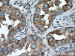 RAB8B Antibody in Immunohistochemistry (Paraffin) (IHC (P))