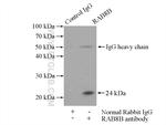 RAB8B Antibody in Immunoprecipitation (IP)