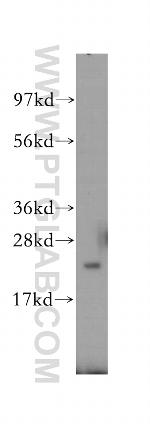 RAB8B Antibody in Western Blot (WB)