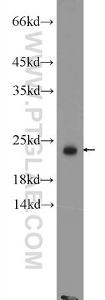 RAB8B Antibody in Western Blot (WB)