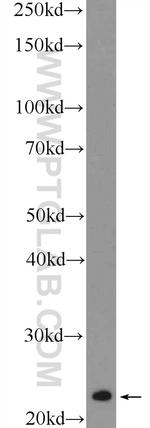 RAB8B Antibody in Western Blot (WB)