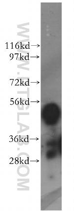 KYNU Antibody in Western Blot (WB)