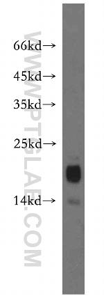 NA14 Antibody in Western Blot (WB)