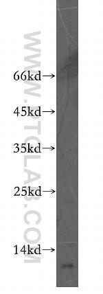 NA14 Antibody in Western Blot (WB)