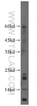 NA14 Antibody in Western Blot (WB)