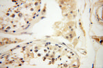 POPDC3 Antibody in Immunohistochemistry (Paraffin) (IHC (P))