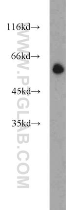POPDC3 Antibody in Western Blot (WB)