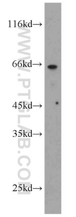 POPDC3 Antibody in Western Blot (WB)