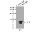 TOM20 Antibody in Immunoprecipitation (IP)