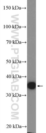 Annexin A3 Antibody in Western Blot (WB)