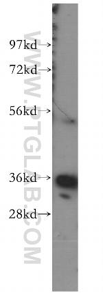 Annexin A3 Antibody in Western Blot (WB)