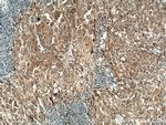 RAB10 Antibody in Immunohistochemistry (Paraffin) (IHC (P))