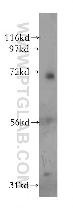 PSG1 Antibody in Western Blot (WB)