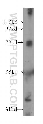 PSG1 Antibody in Western Blot (WB)