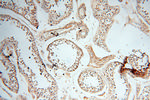 ANKRD2 Antibody in Immunohistochemistry (Paraffin) (IHC (P))