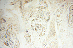 ANKRD2 Antibody in Immunohistochemistry (Paraffin) (IHC (P))