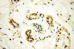 ANKRD2 Antibody in Immunohistochemistry (Paraffin) (IHC (P))