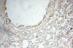 ANKRD2 Antibody in Immunohistochemistry (Paraffin) (IHC (P))