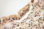 ANKRD2 Antibody in Immunohistochemistry (Paraffin) (IHC (P))