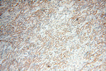 ANKRD2 Antibody in Immunohistochemistry (Paraffin) (IHC (P))