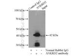 ANKRD2 Antibody in Immunoprecipitation (IP)