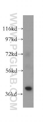 ANKRD2 Antibody in Western Blot (WB)