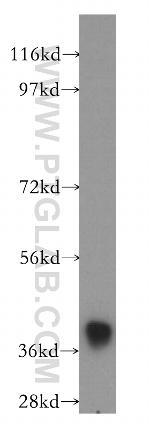 ANKRD2 Antibody in Western Blot (WB)