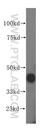 ANKRD2 Antibody in Western Blot (WB)
