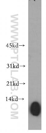 VAMP5 Antibody in Western Blot (WB)