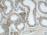 CIB1 Antibody in Immunohistochemistry (Paraffin) (IHC (P))