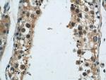 CIB1 Antibody in Immunohistochemistry (Paraffin) (IHC (P))