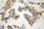 CIB1 Antibody in Immunohistochemistry (Paraffin) (IHC (P))