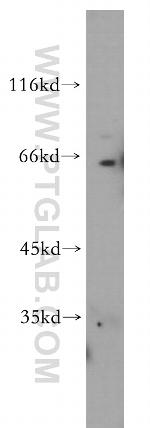 RAG2 Antibody in Western Blot (WB)