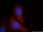 FGL2 Antibody in Immunocytochemistry (ICC/IF)