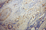 FGL2 Antibody in Immunohistochemistry (Paraffin) (IHC (P))