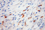 FGL2 Antibody in Immunohistochemistry (Paraffin) (IHC (P))