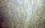 FGL2 Antibody in Immunohistochemistry (Paraffin) (IHC (P))