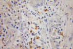 FGL2 Antibody in Immunohistochemistry (Paraffin) (IHC (P))